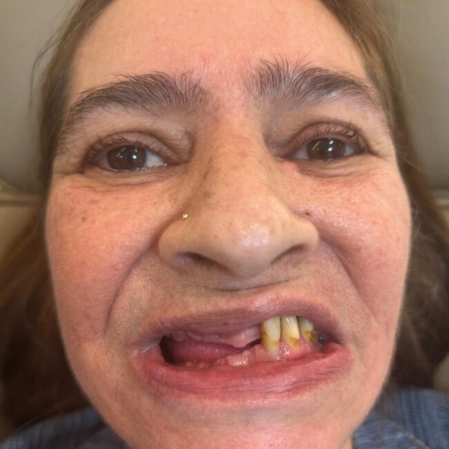 Protocolo caga dental na zona norte (10)