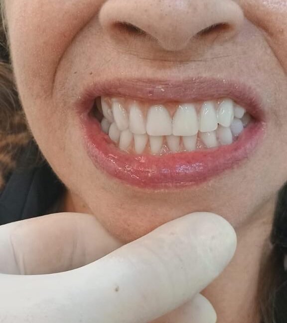 Protocolo caga dental na zona norte (11)