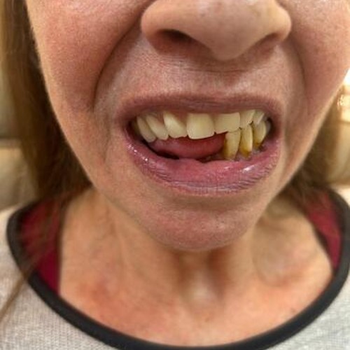 Protocolo caga dental na zona norte (12)