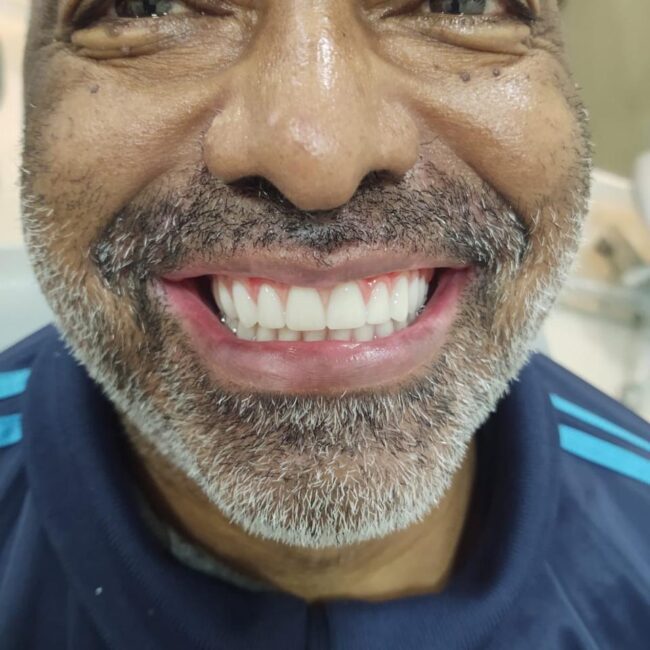 Protocolo caga dental na zona norte (14)