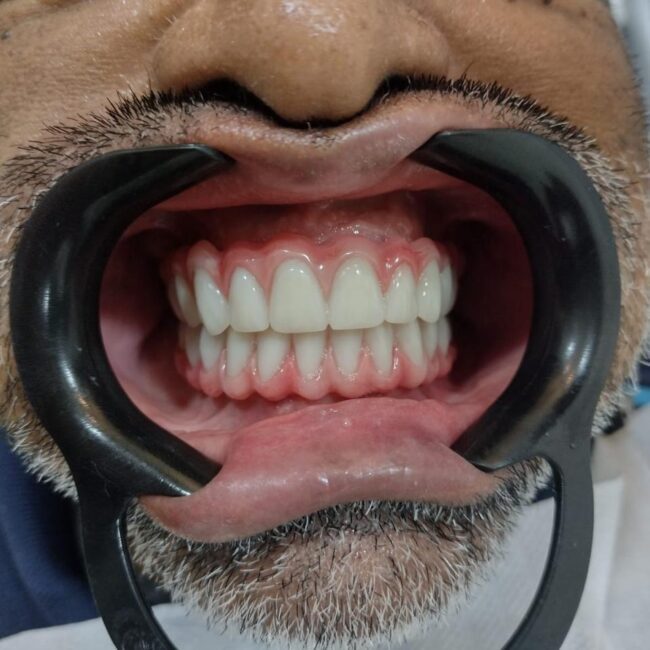 Protocolo caga dental na zona norte (16)