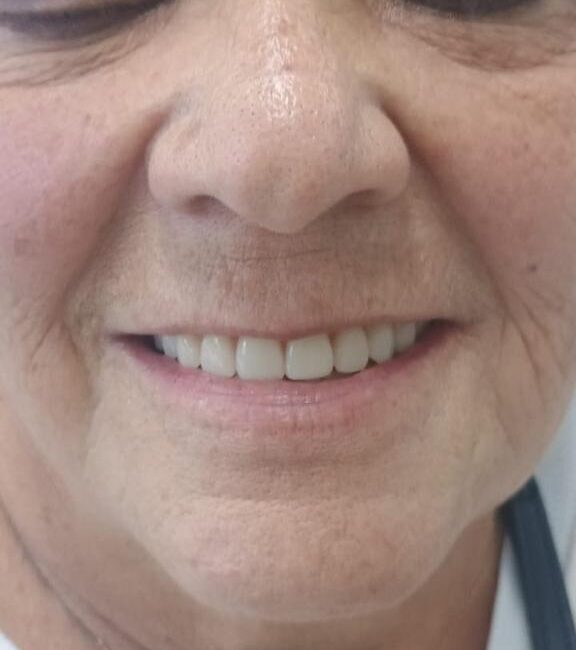 Protocolo caga dental na zona norte (17)