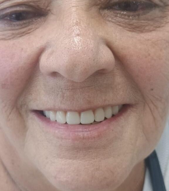 Protocolo caga dental na zona norte (18)