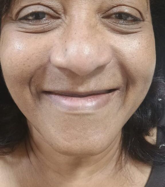 Protocolo caga dental na zona norte (21)