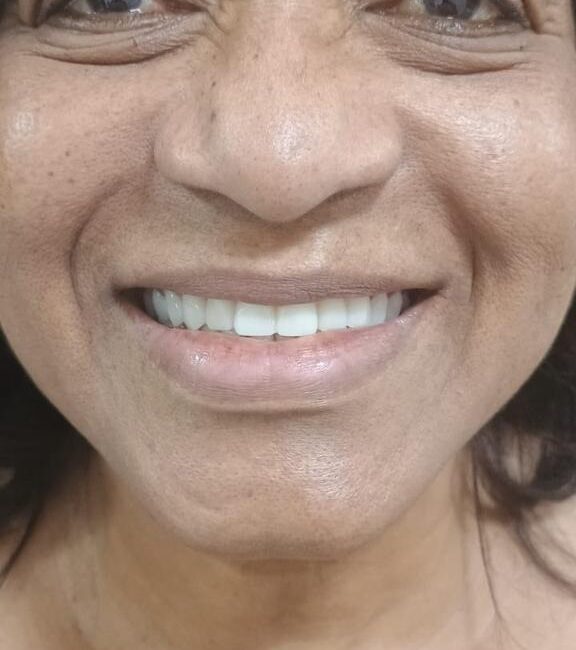 Protocolo caga dental na zona norte (22)