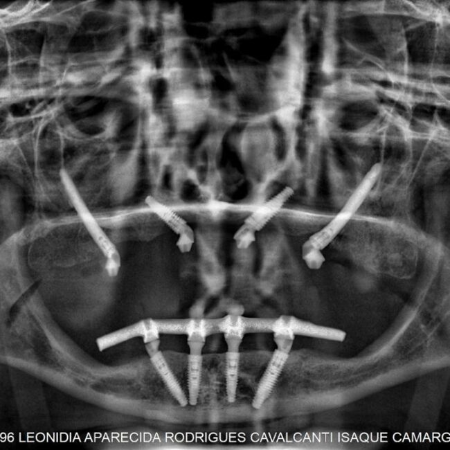 Protocolo caga dental na zona norte (4)