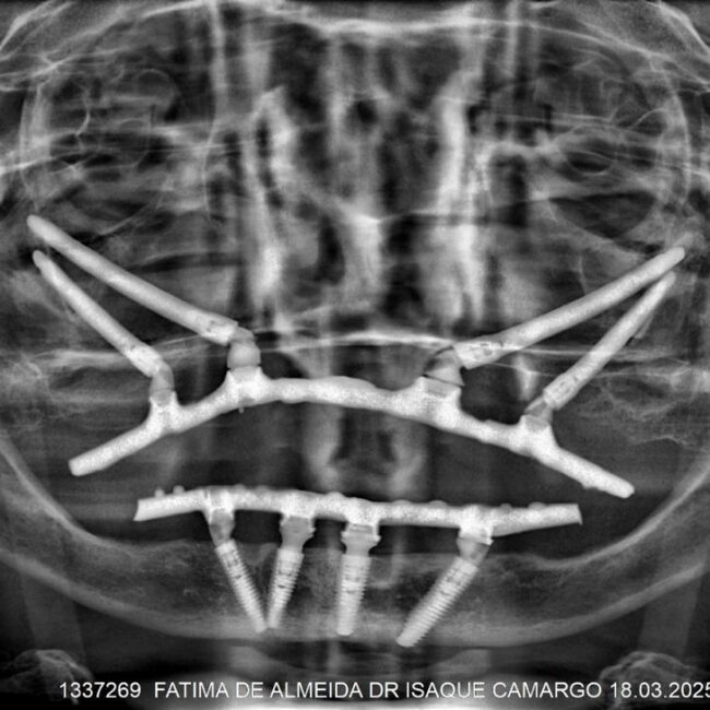 Protocolo caga dental na zona norte (5)