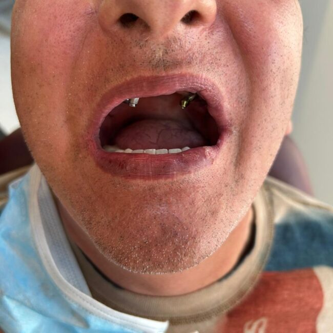 Protocolo caga dental na zona norte (6)