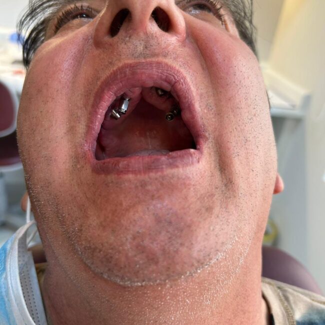 Protocolo caga dental na zona norte (8)