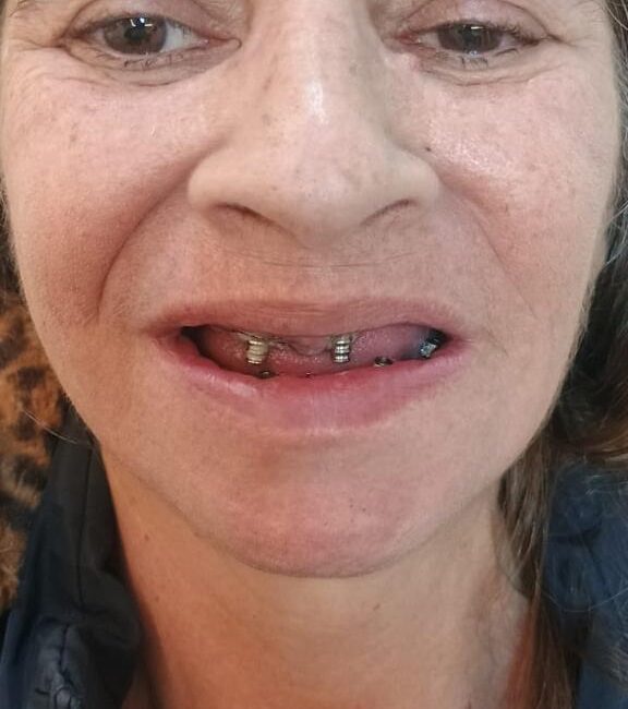 Protocolo caga dental na zona norte (9)